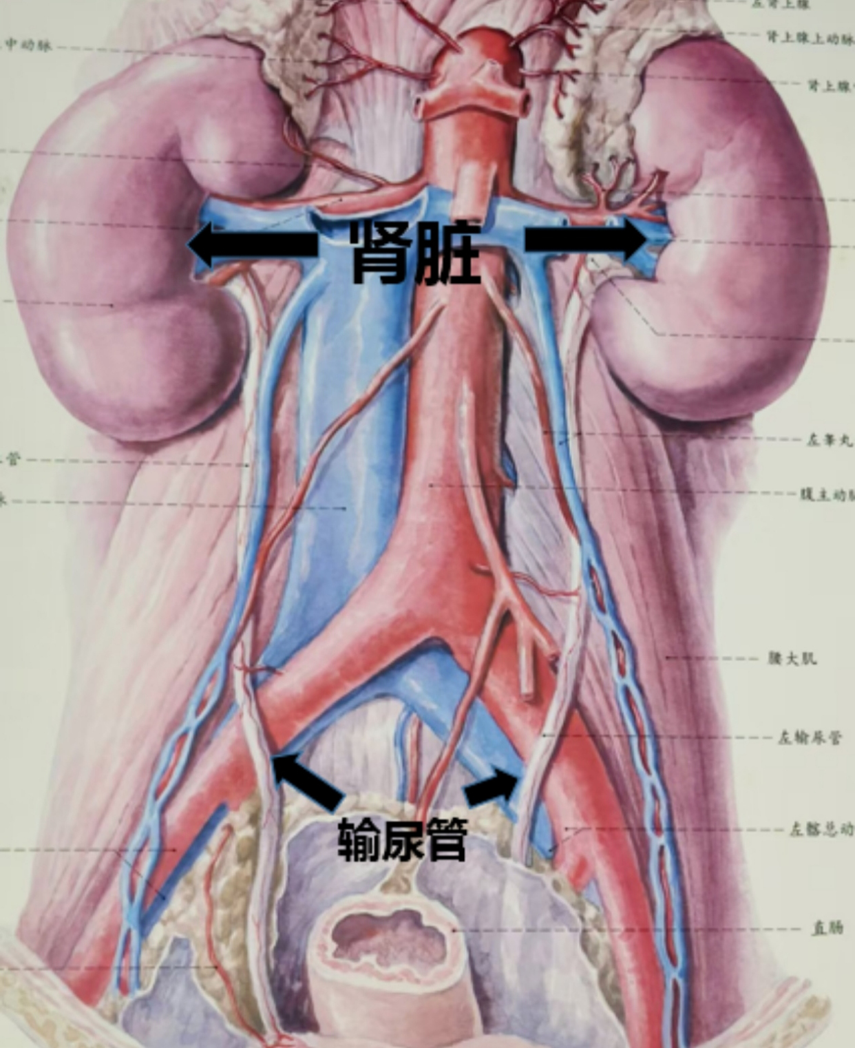 输尿管变成"麻花",输尿管膀胱交界梗阻!关勇主任手术经典报道