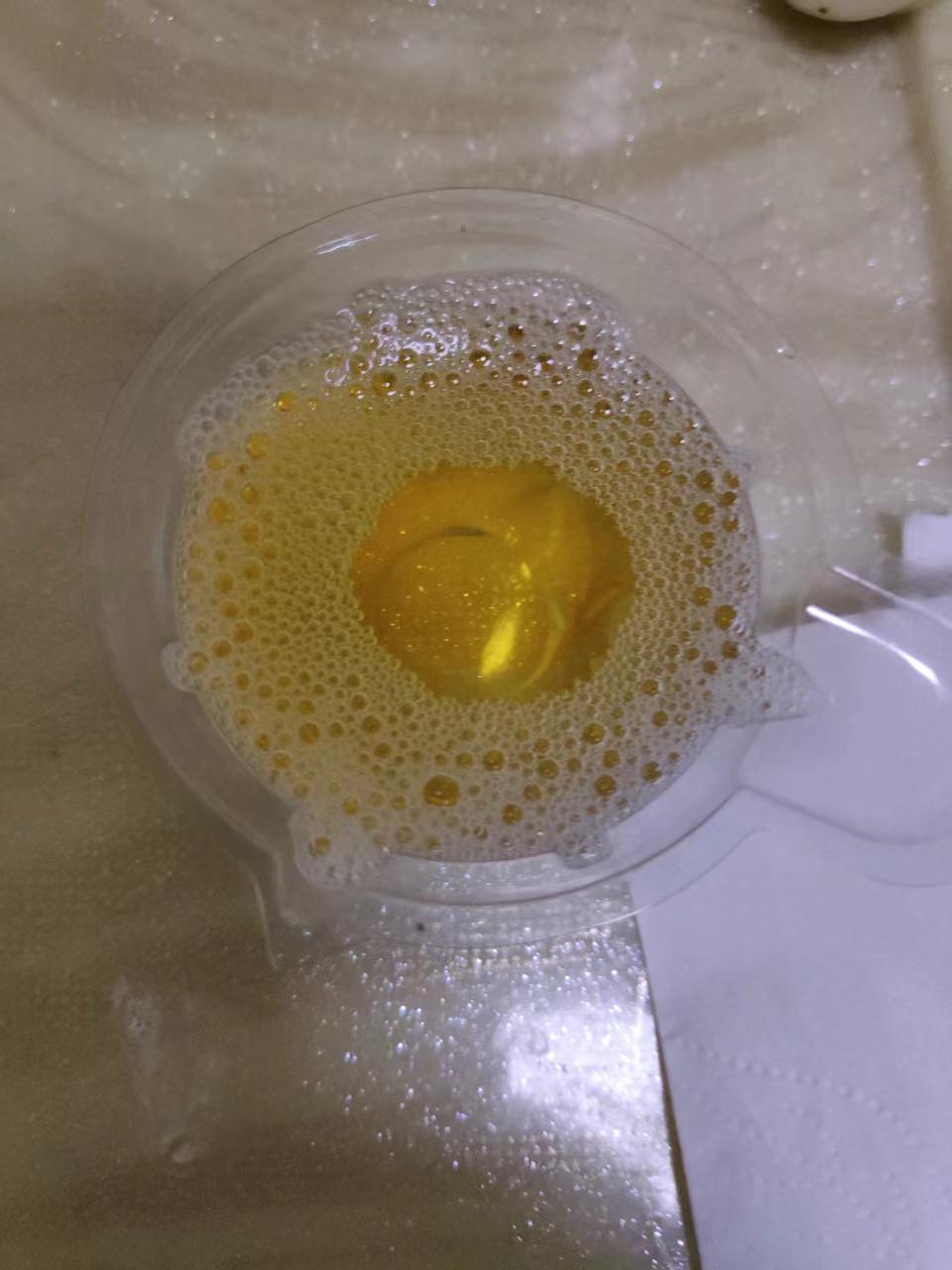一起聊聊蛋白尿