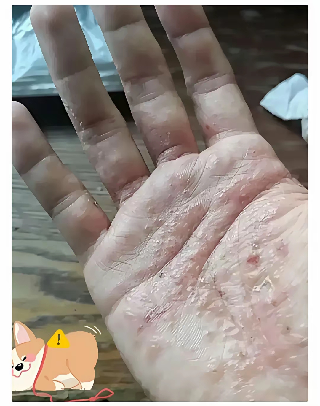 年了,中药西药堆成山,跑遍医院,试偏方,一点用都没,每天痒得抓心挠肝