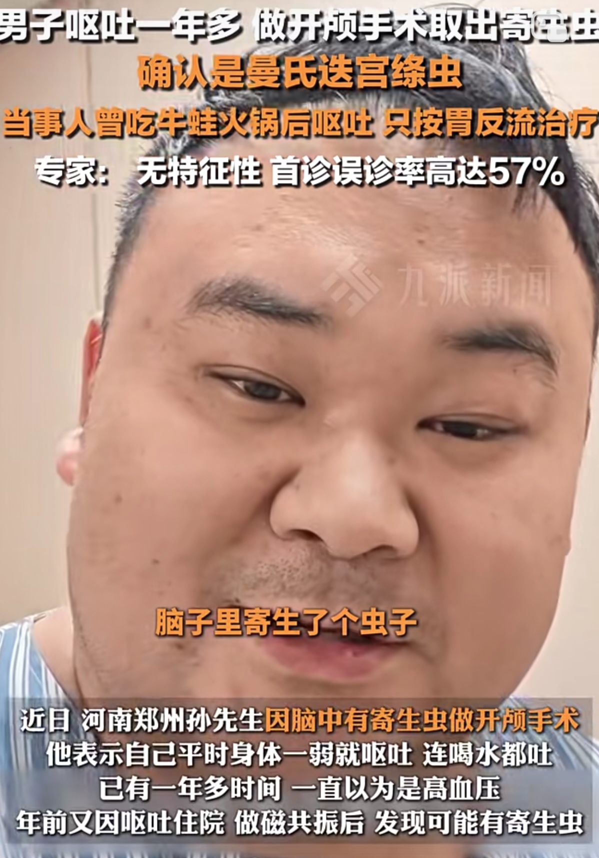 脑袋里寄生了个虫子,需要开颅手术才能取出,挺可怕