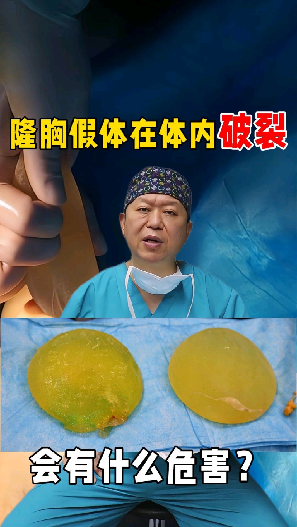 别忽视!隆胸假体破裂不是小事,可能引发这些健康问题