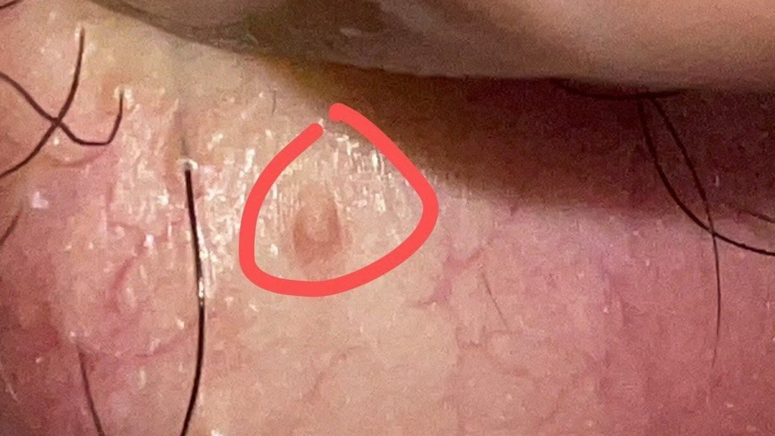 我去医院做了hpv检查,医院只做了6.11.16.18阴性