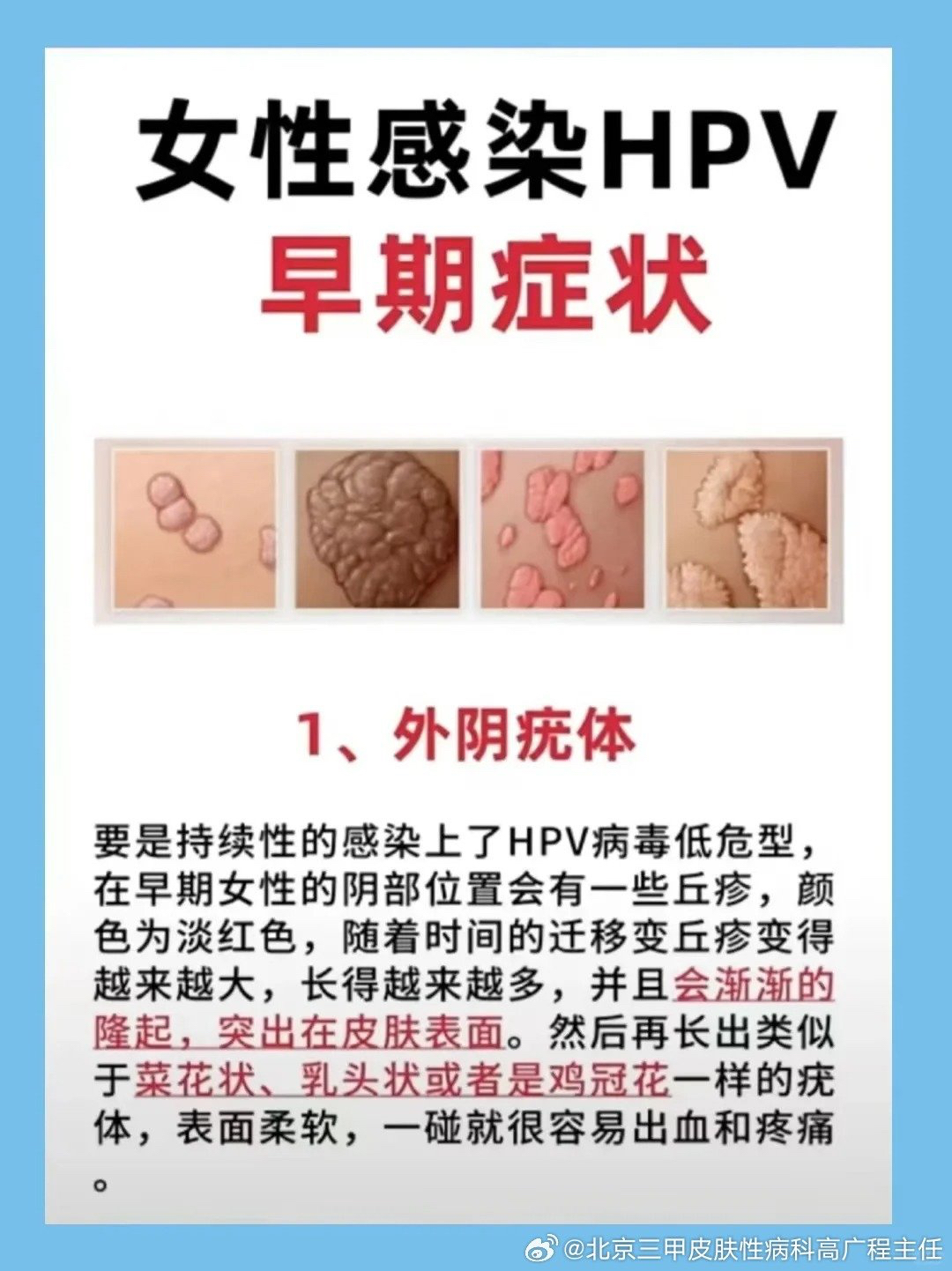 女生感染hpv早期症状