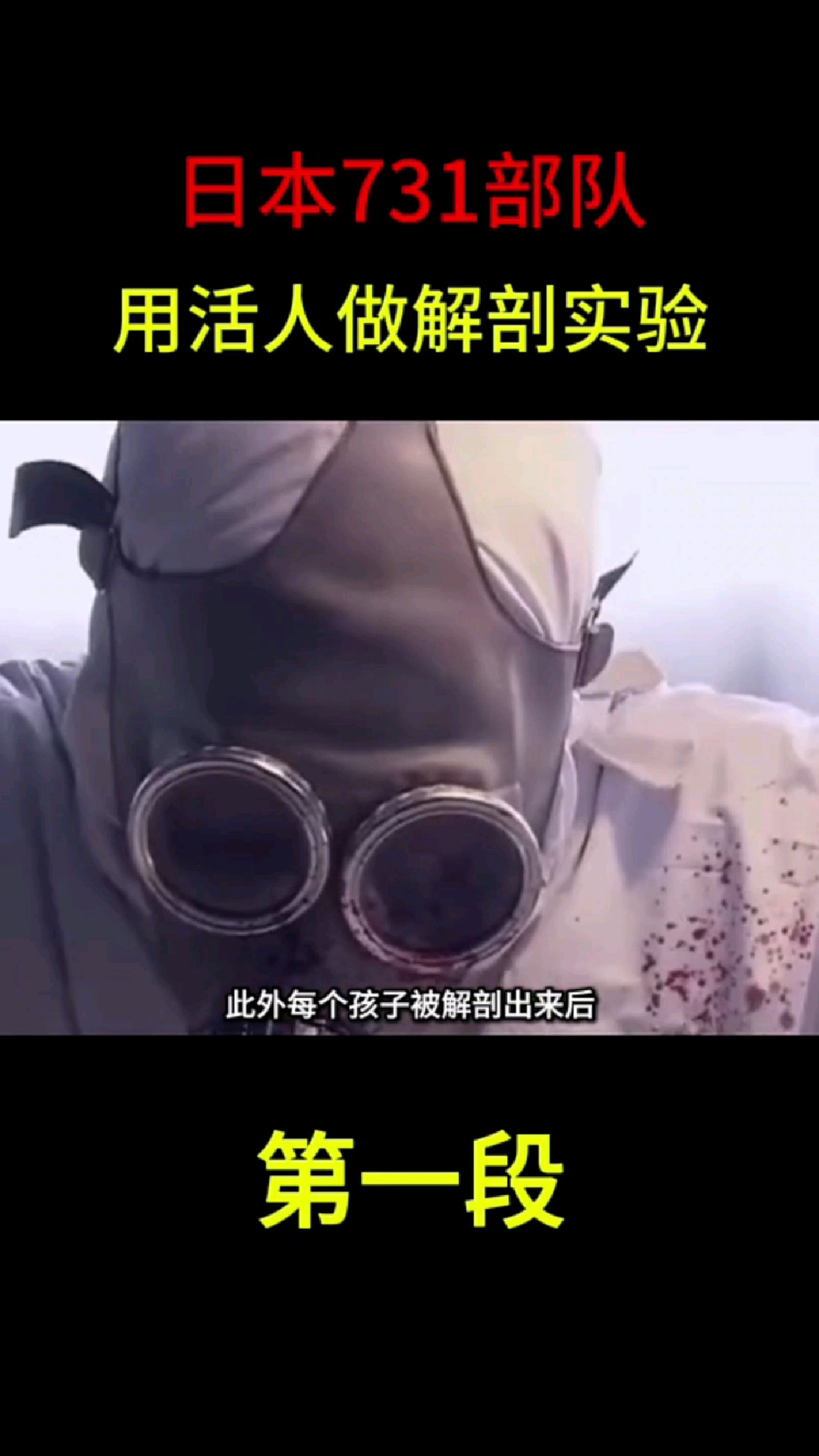 日本731部队,用活人做解剖实验,手段残忍至极