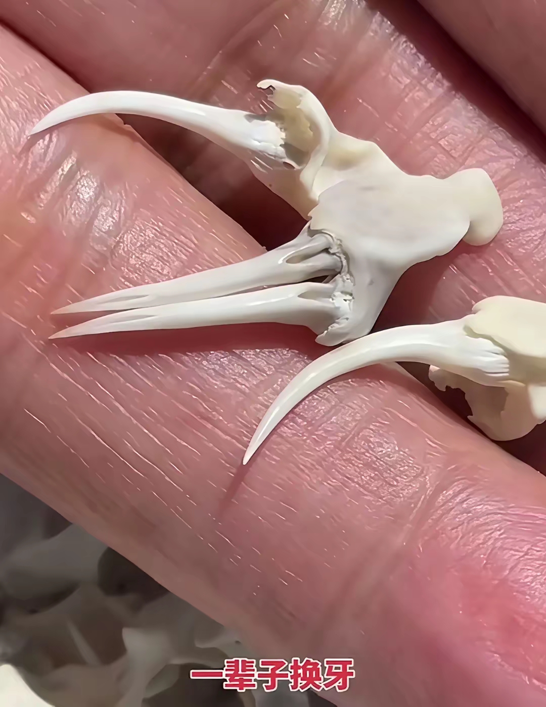 这就是有毒蛇类的牙齿,每颗牙齿都像一颗针管,蛇咬住异物时会通过牙齿