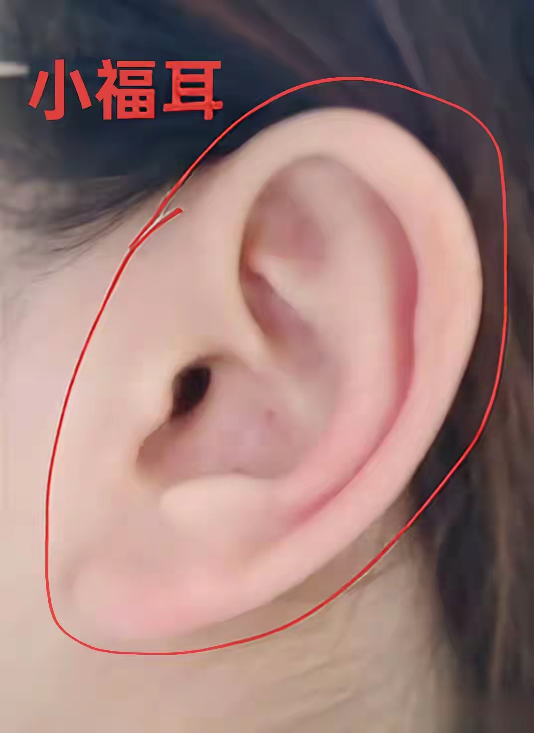 男女生有小福耳代表什么? 拥有小福耳者,天生福运