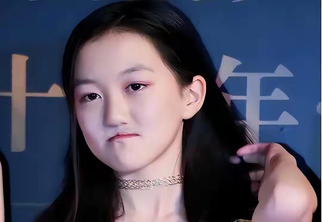 唇裂治疗:王菲女儿李嫣接受了复杂的唇裂修复手术,手术过程中出现了