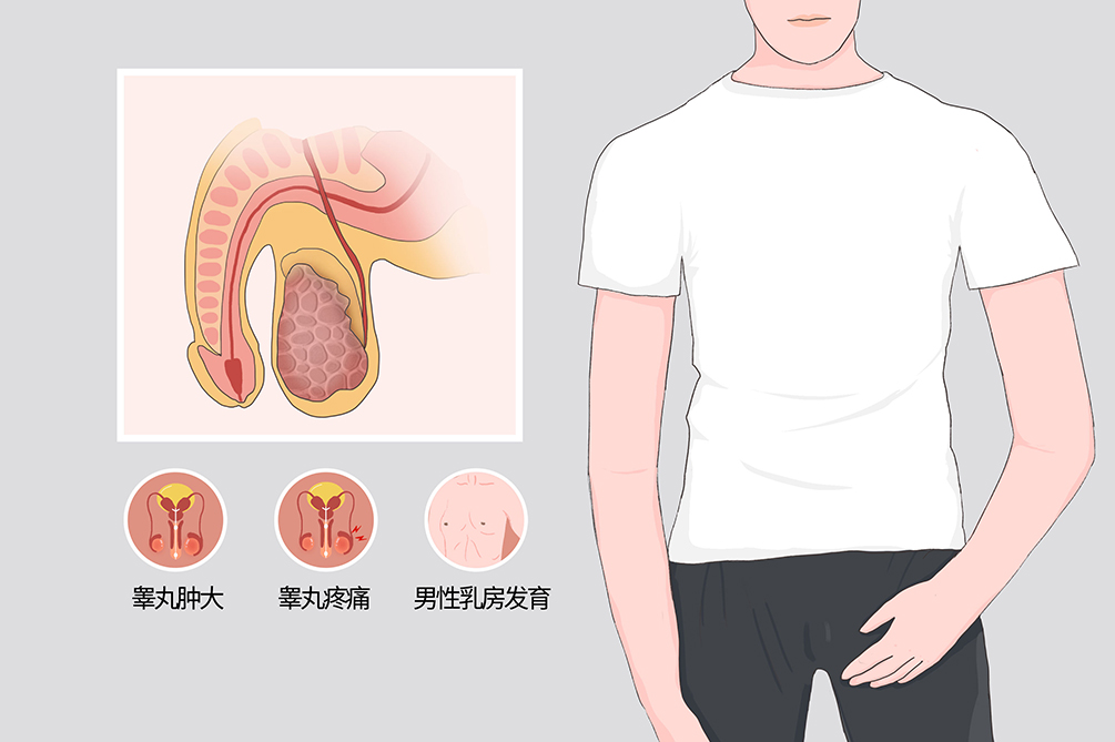 关于睾丸健康的信息 关于睾丸康健
的信息（关于睾丸康健的信息有哪些） 健康