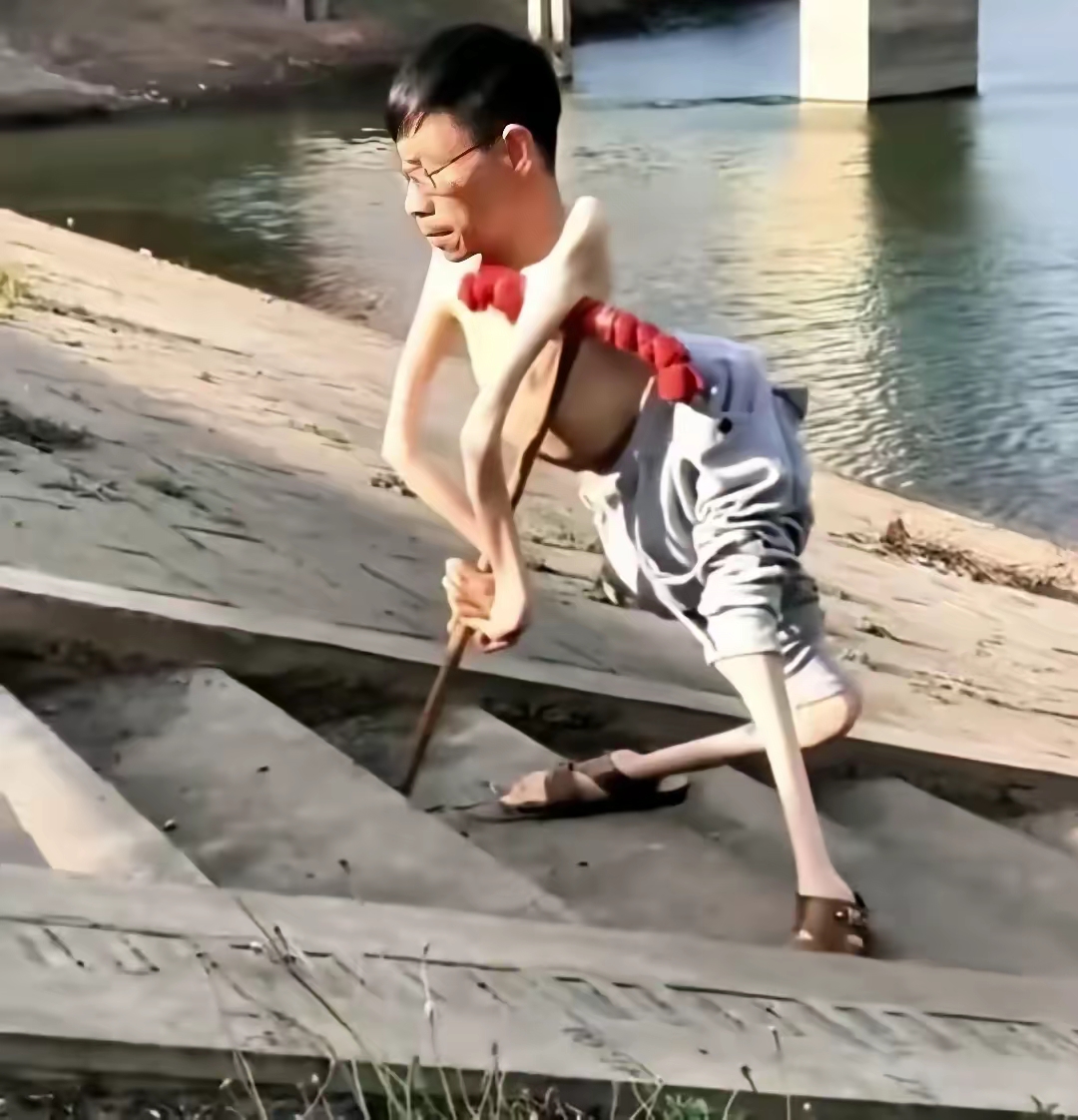 身残志坚的他,没想到已经是四个孩子的父亲了,他叫张文新,患有天生的