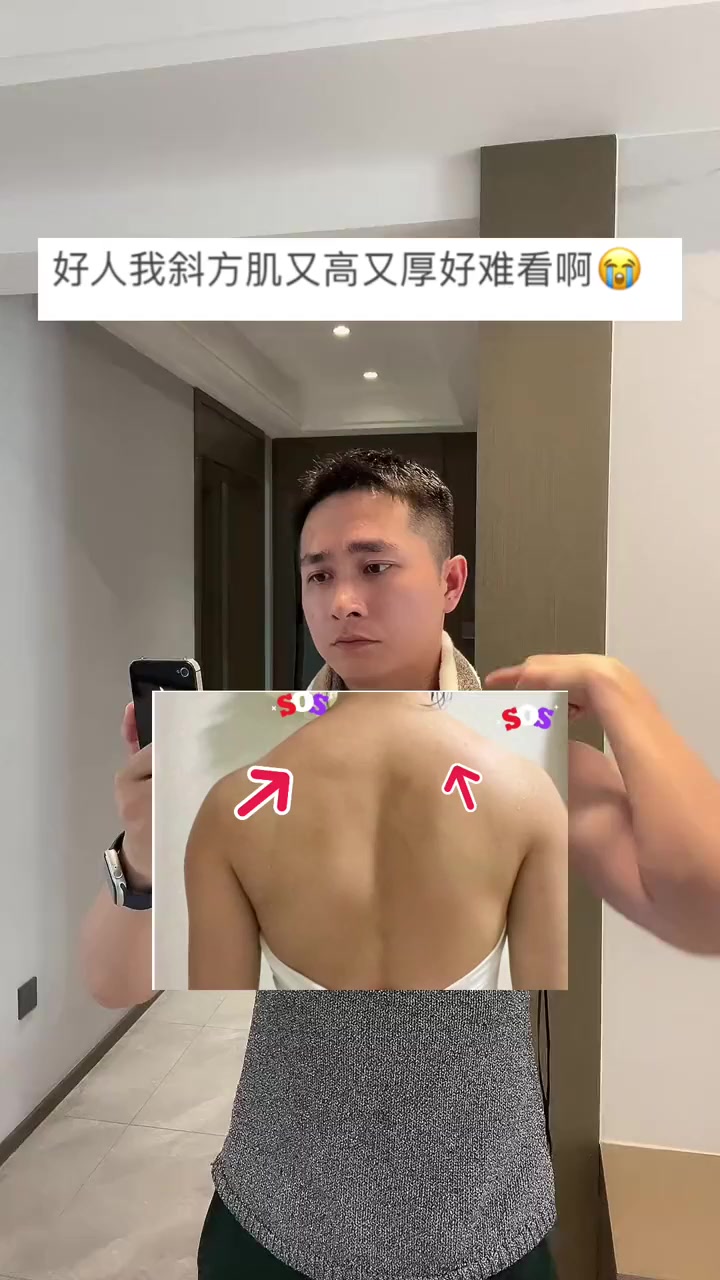 斜方肌太厚一招教你轻松薄背!