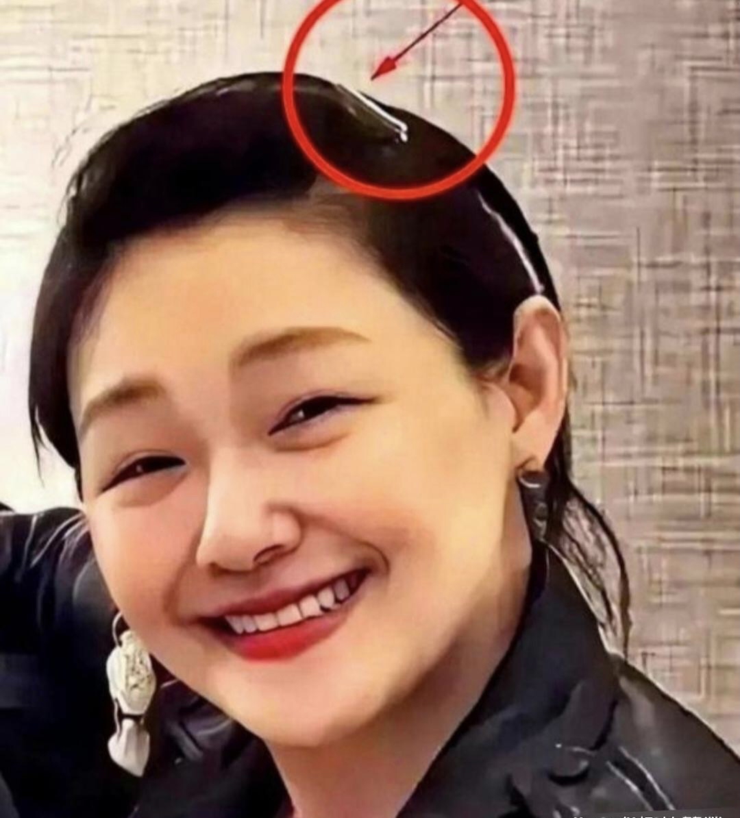 就拿大s去日本前拍的照片来说看着就不正常脸肿得像充了气似的