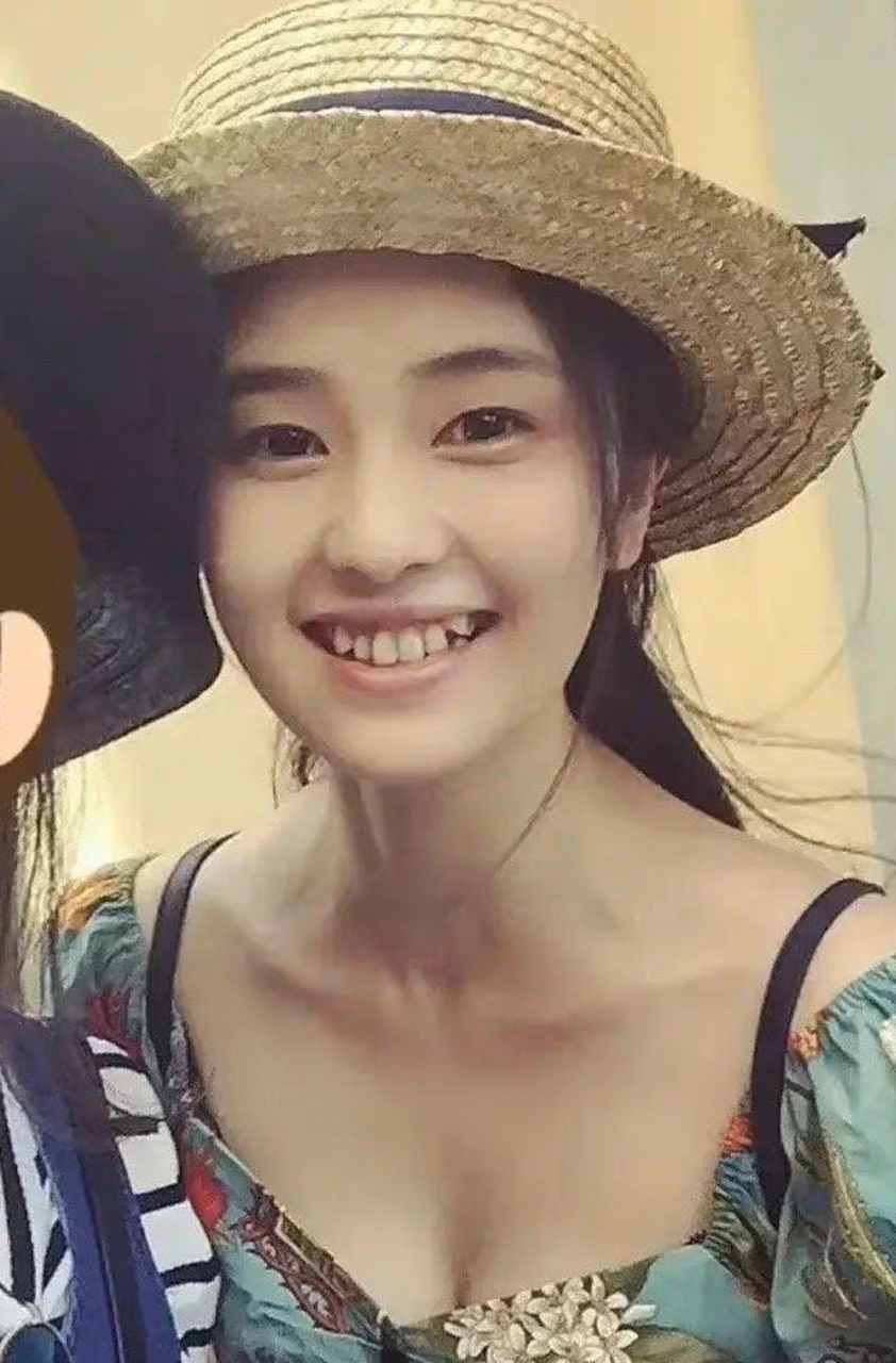 整牙前的白鹿vs整牙后的白鹿