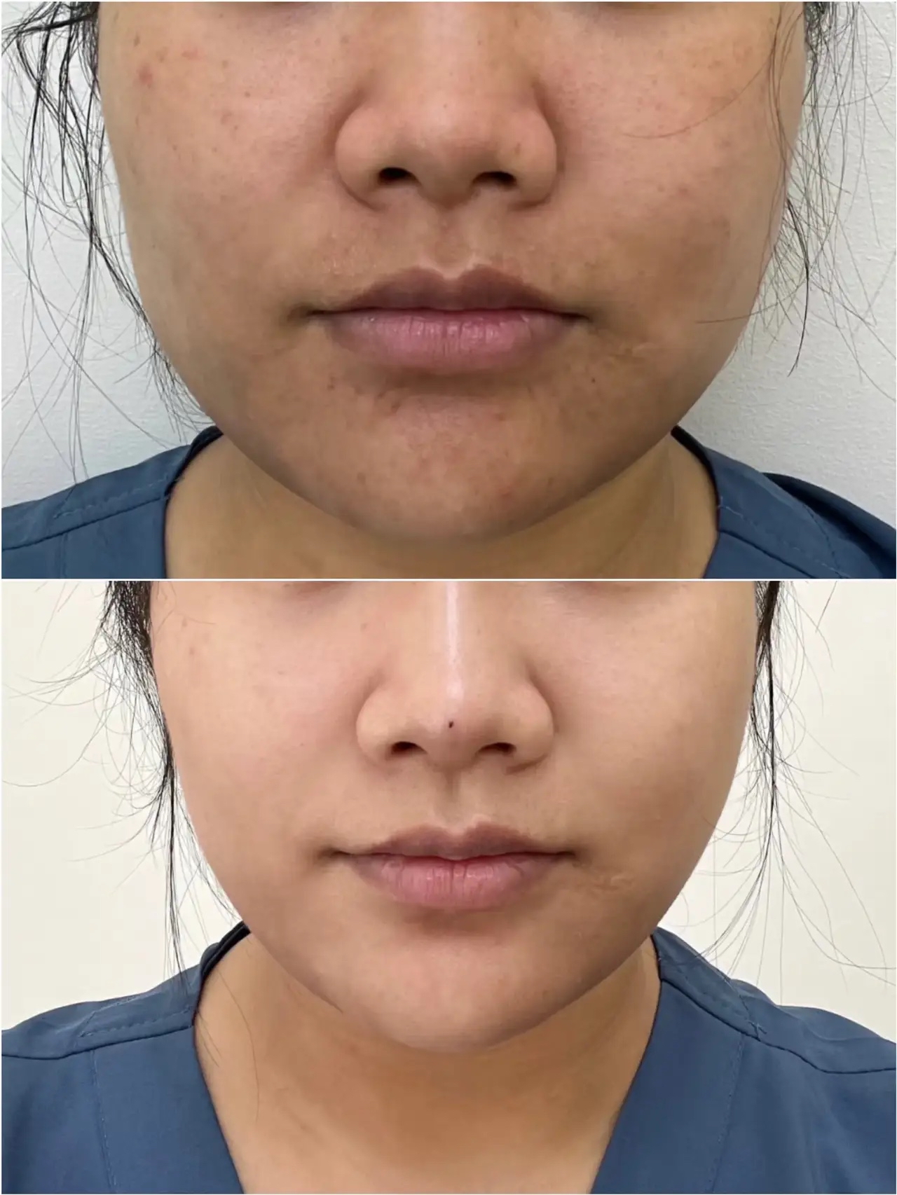 早晚护肤两不干悄悄嫩回十年前