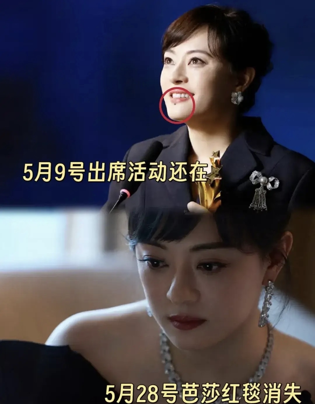 孙俪把唇下痣去掉了 不是因为怕影响颜值也不是粉丝跪求她点痣而是