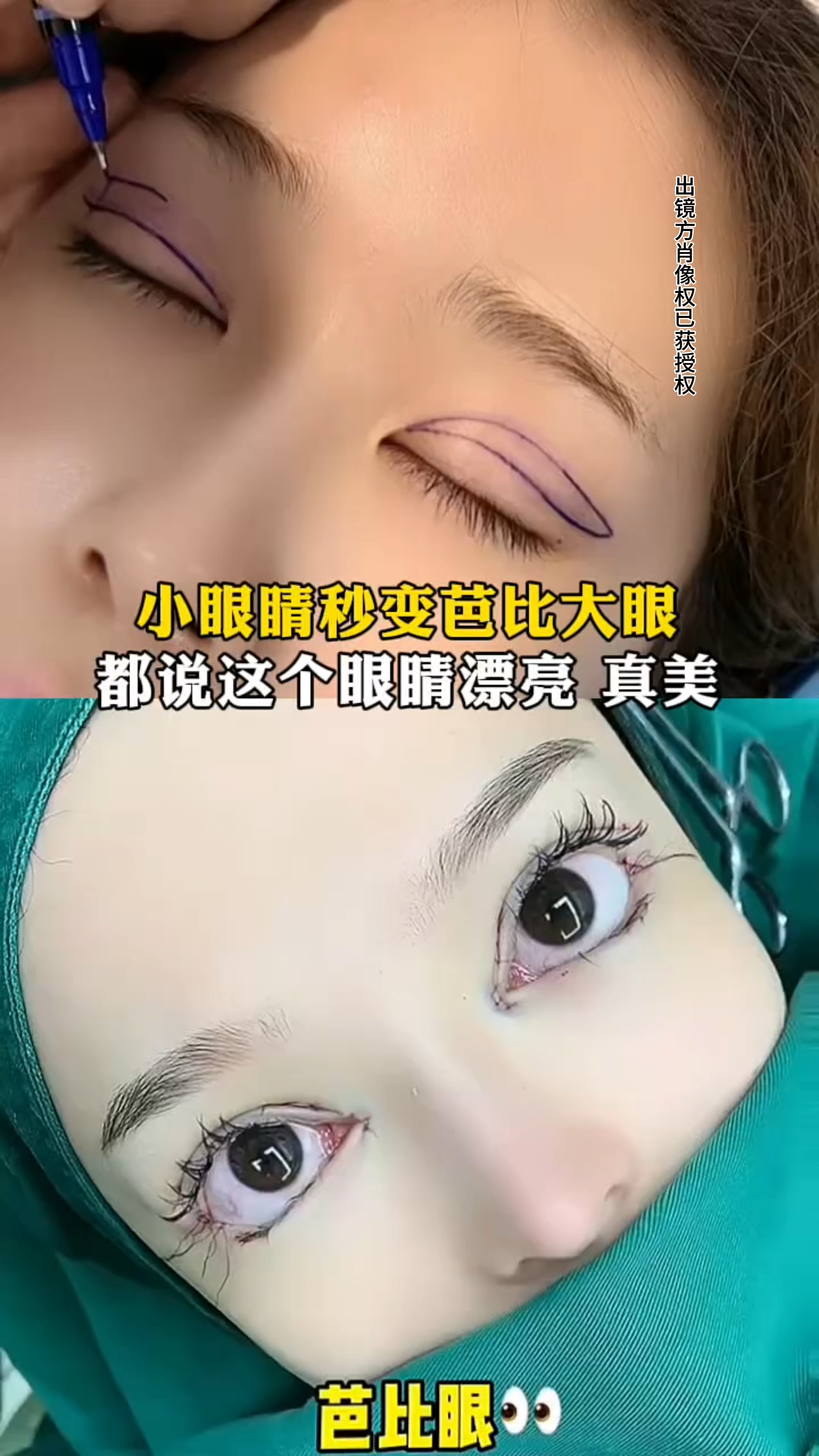 小眼睛秒变芭比大眼