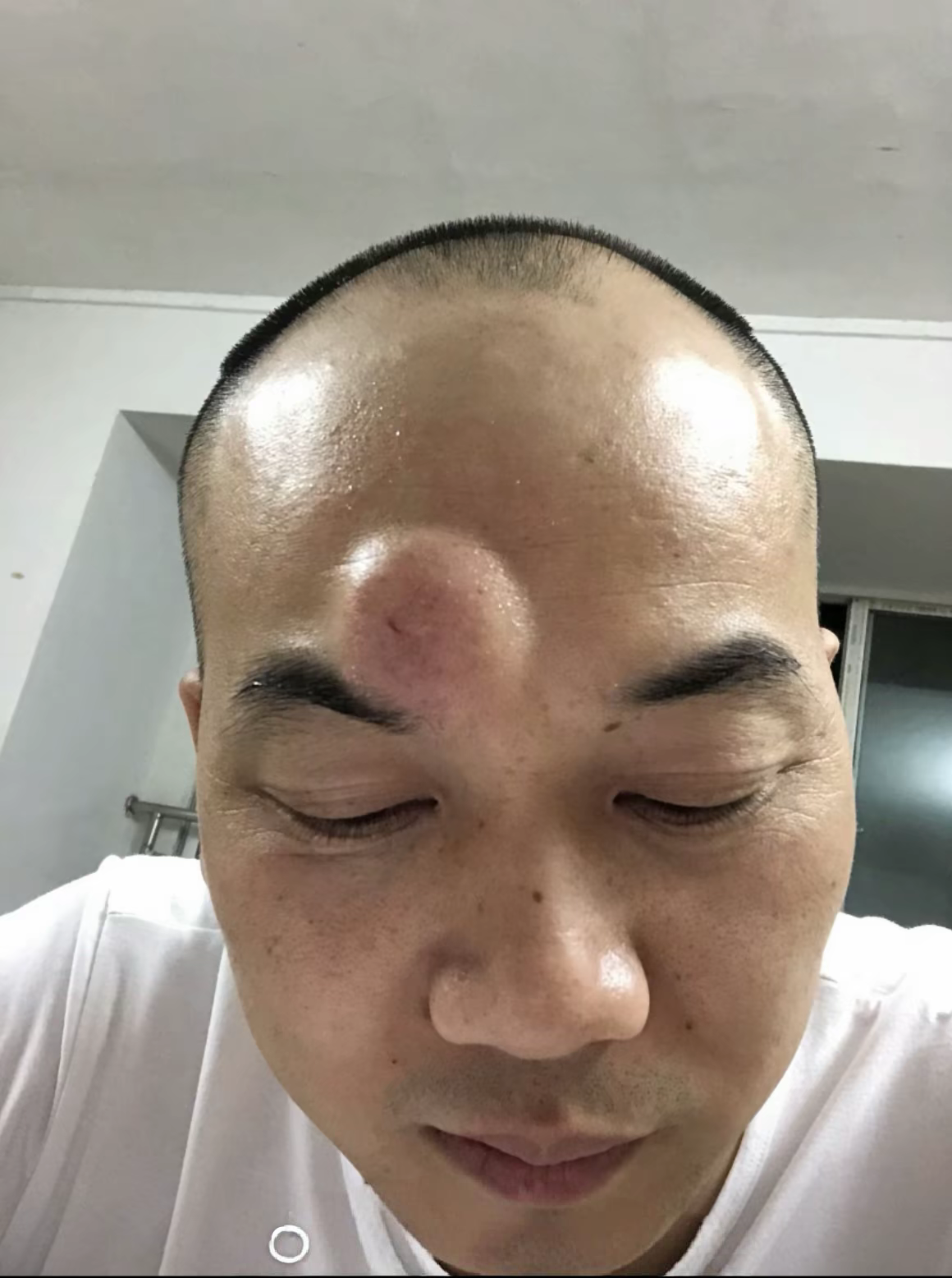 事实证明:头比台球硬!