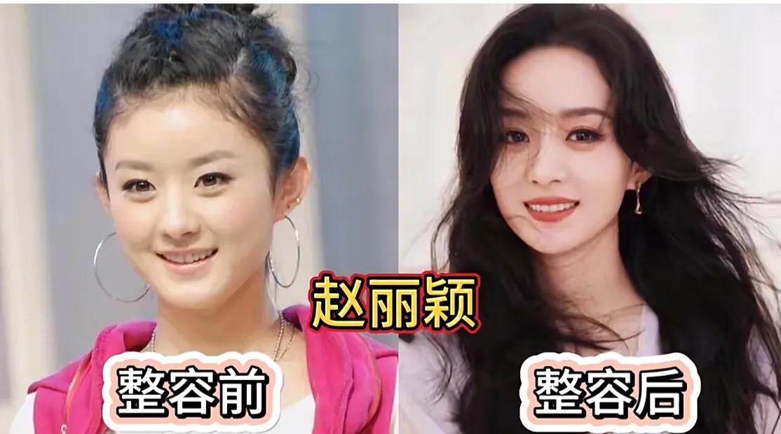 盘点娱乐圈9位女明星整容后对比,你认识几位?