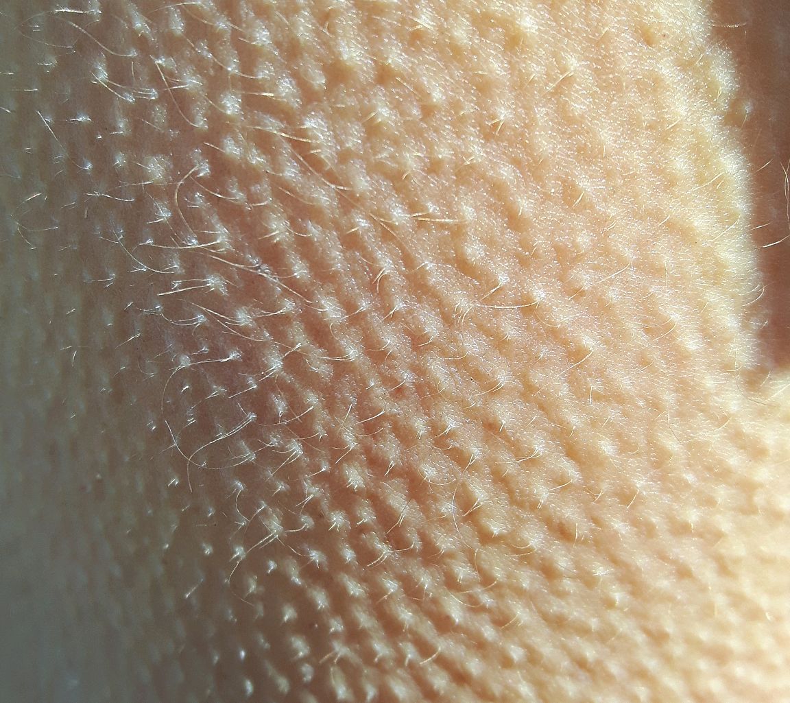 为什么一遇冷就起鸡皮疙瘩?人体"毛发竖立"的秘密,这么科学!