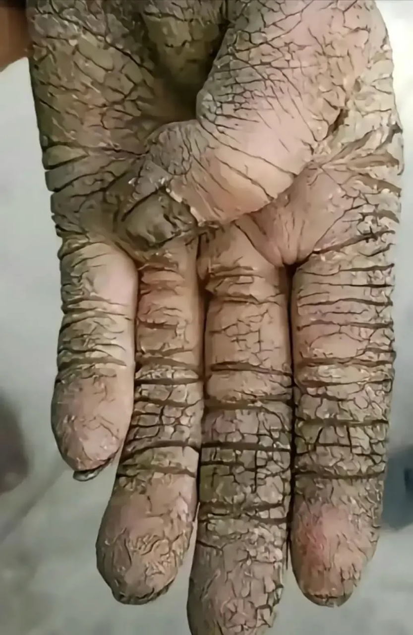 忽然对勤劳能致富产生了疑问.  这双手的主人够勤劳的吧,他富了吗?