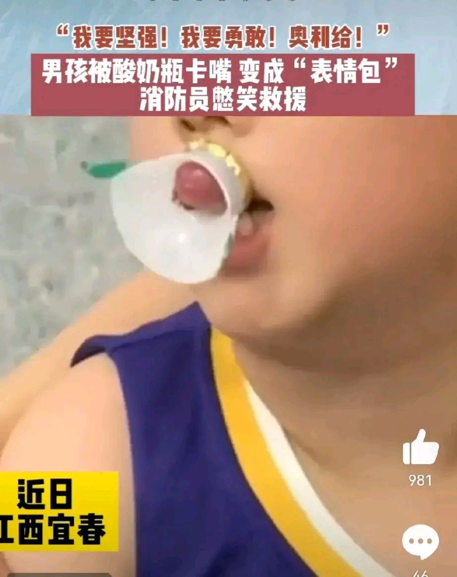 男孩被酸奶瓶卡嘴,秒变"表情包",消防站憋笑救援. 近日,江西宜春.
