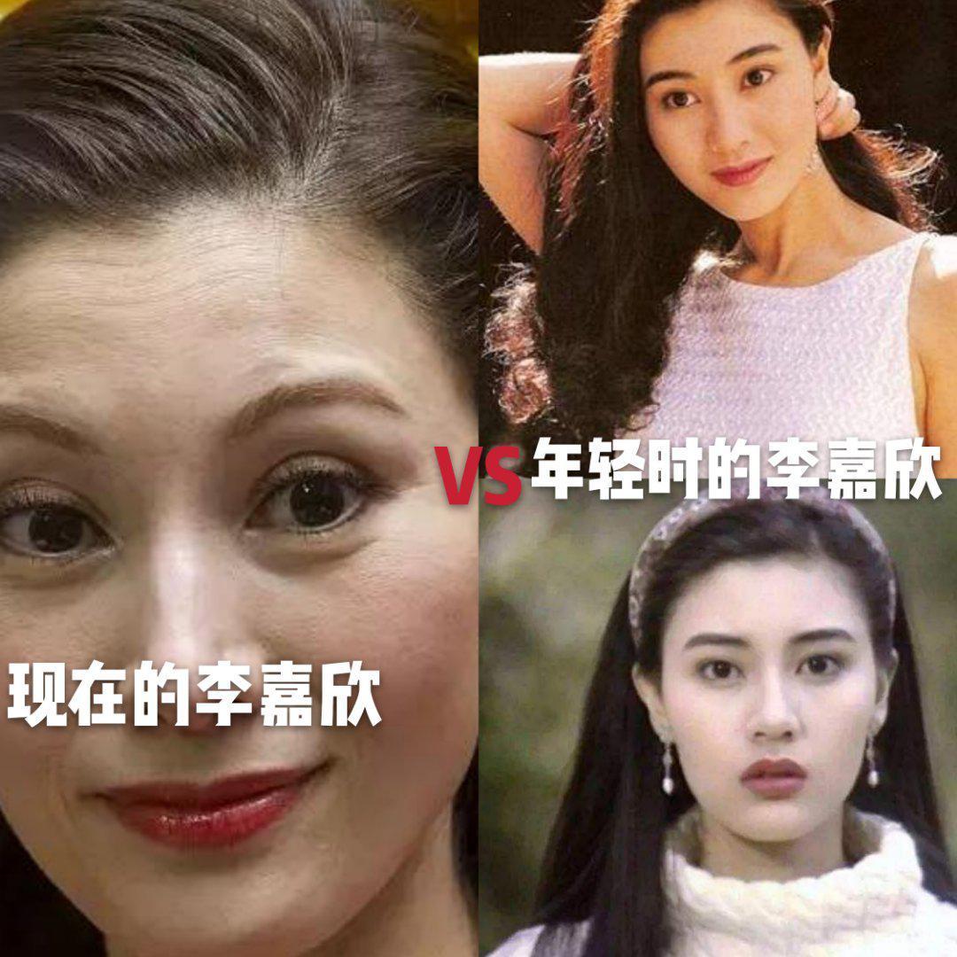 红颜易老,美人迟暮!港台女明星今昔容颜对比,看看谁是整容脸