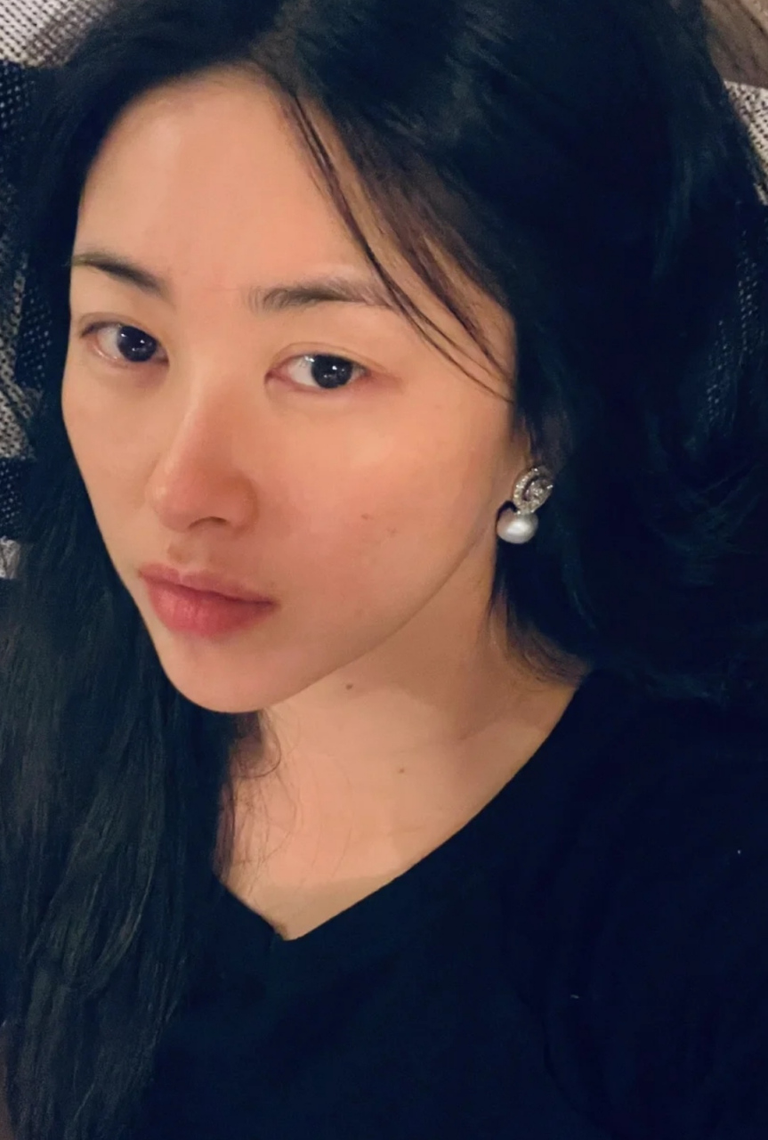 朱珠晒纯素颜了,脸颊和脖子上都有痣,眼睛没那么有神采了,不过尖下巴