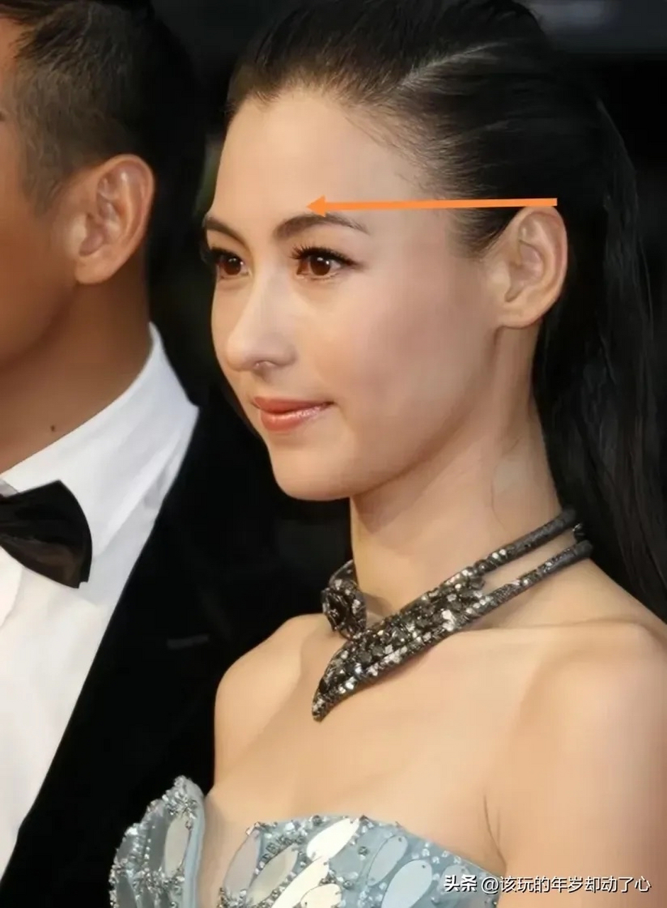 张柏芝耳朵不但高过于眼睛,还高过于眉毛了,以前听人说耳朵高过于眼睛