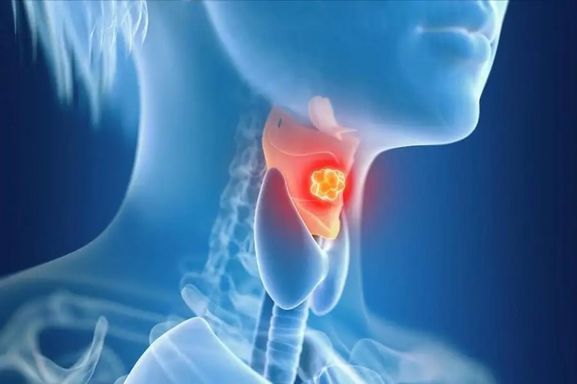 嗓子不舒服,咽喉痛就是"二阳"吗?最近不少人喉咙痛咋回事?