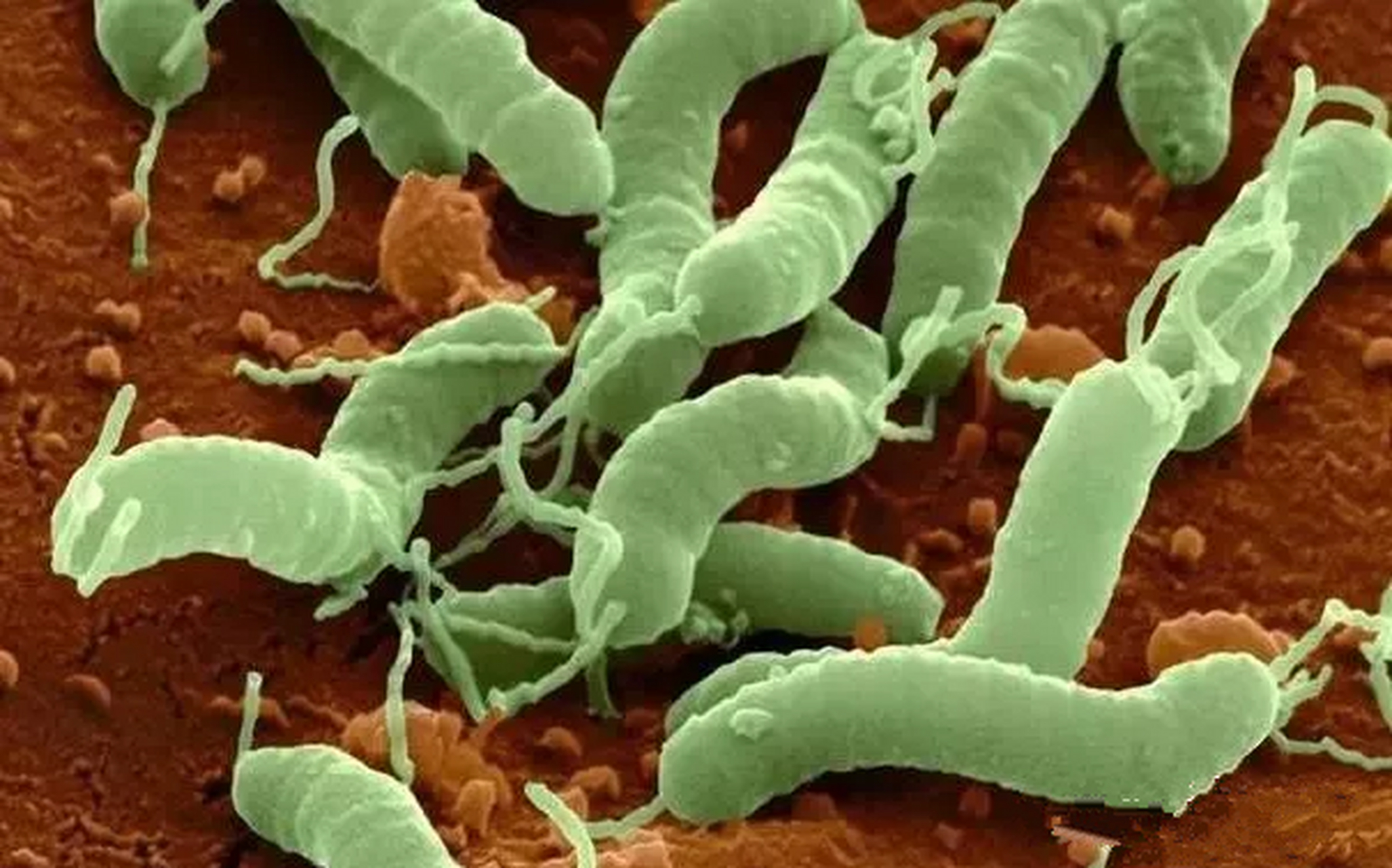 认识幽门螺杆菌  幽门螺杆菌(helicobacter pylori)是一种革兰氏阴性
