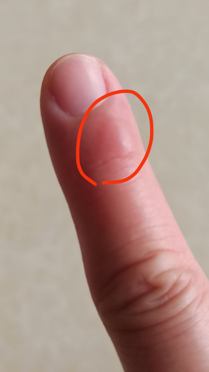 手上又多了两个奇痒无比的蚊子口,擦了半瓶清凉油还无济于事,咬我的