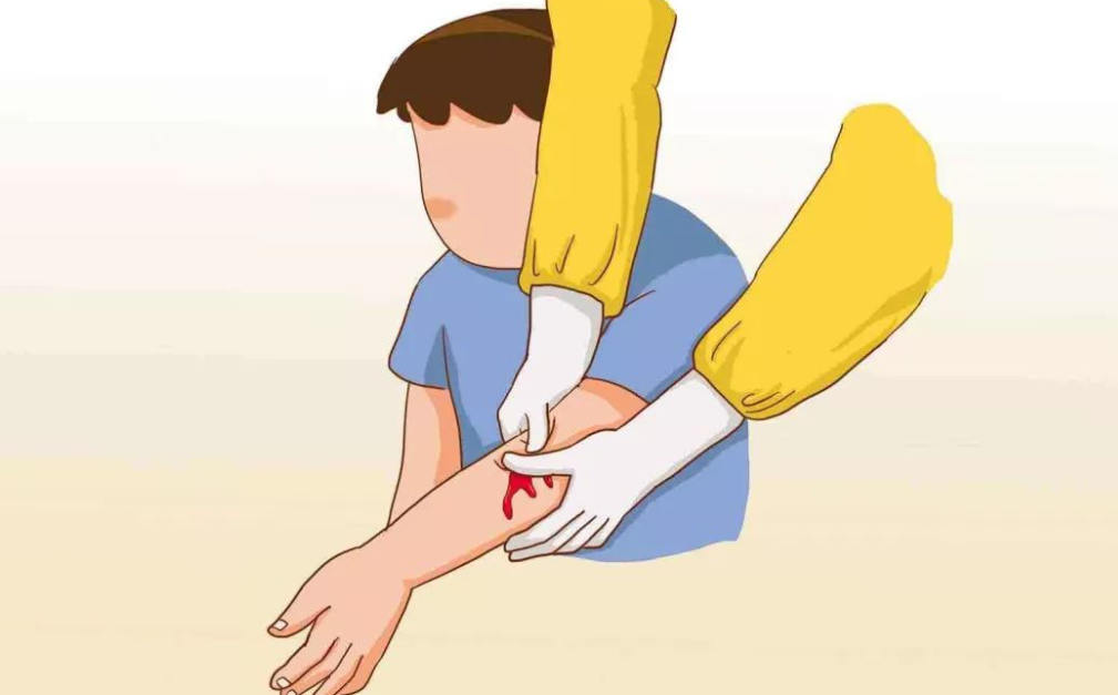 肌肤擦伤后为何要处理干净,如果留下疤痕,有何医美方法可以解决