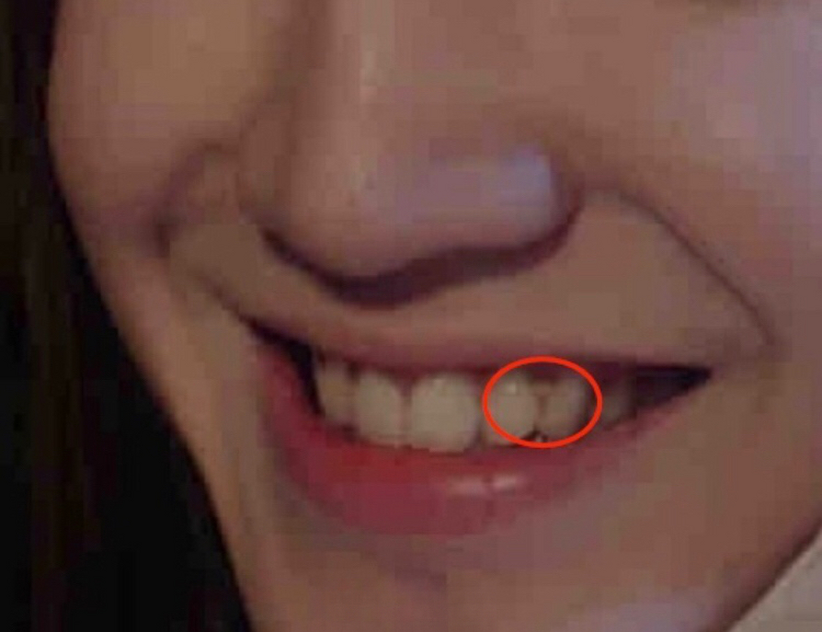 陈哲远这个牙结石,和他拍吻戏的赵露思有什么感想?