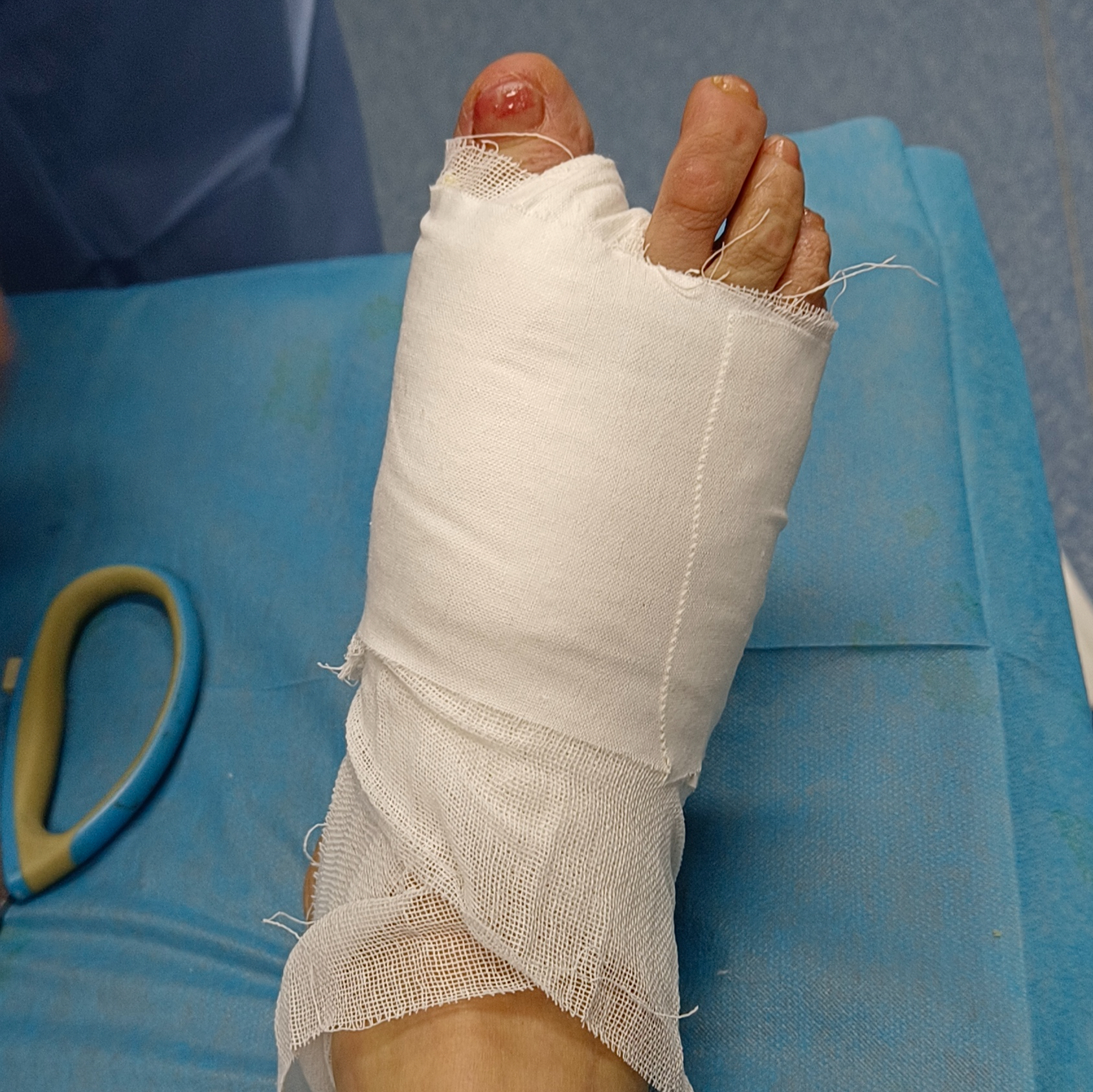 为什么越来越多年轻人不北漂了# 山西宋女士,66岁