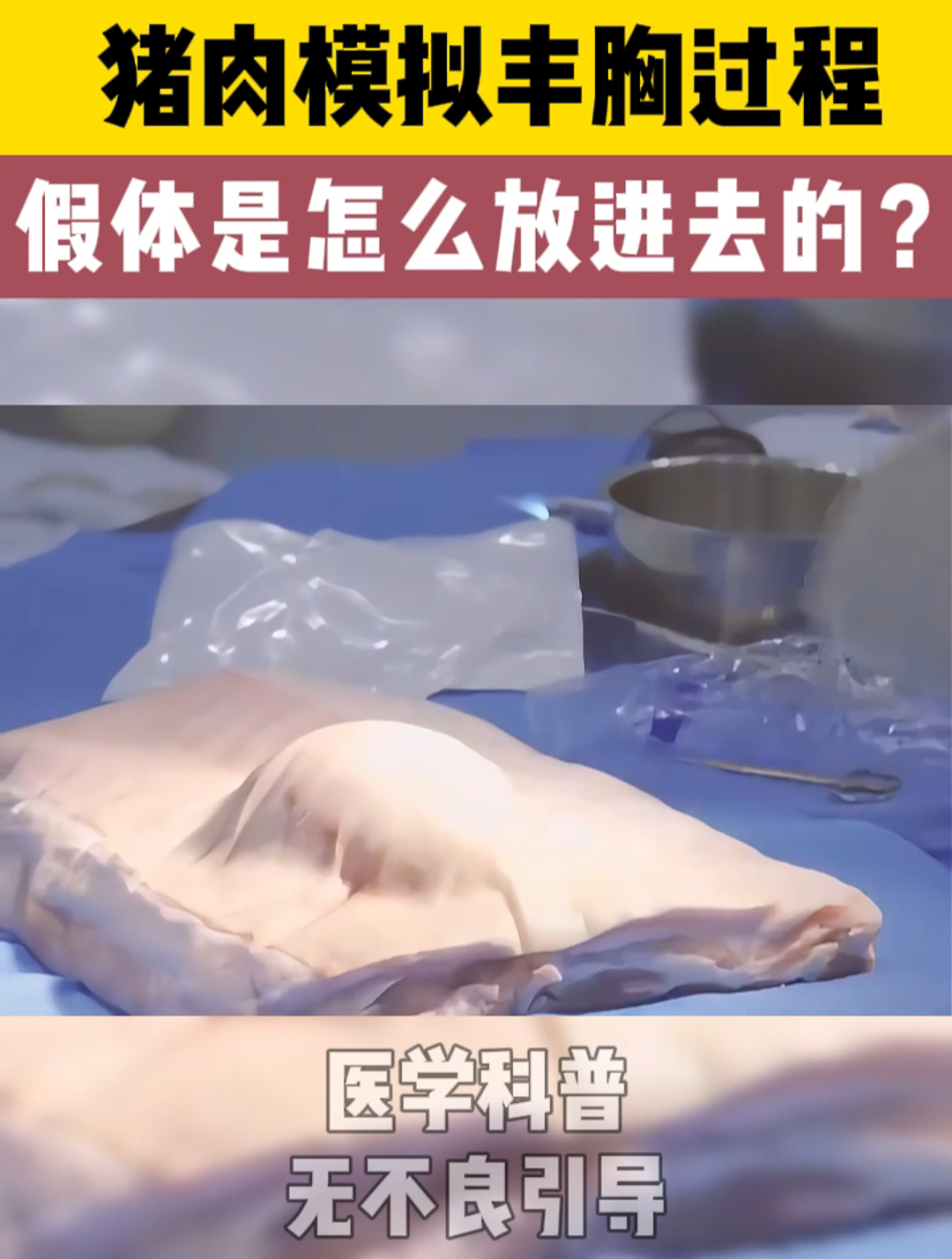 丰胸模拟!这么大的假体究竟是怎么放进去的,点进来看!