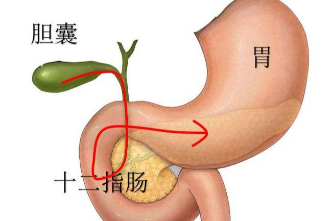 睡觉流黄色口水竟然是胆汁反流性食胃炎?