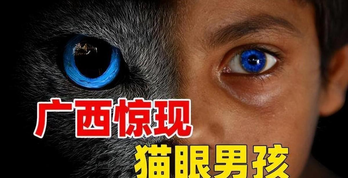 回顾一男童天生拥有蓝眼夜晚看东西如白天检查结果让全家沉默