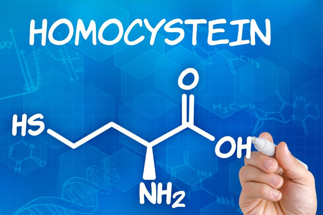 高同型半胱氨酸,是增加脑梗风险的"第四高",怎么降?本文说清