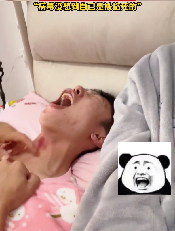 婆婆用土方法抓痧去治疗