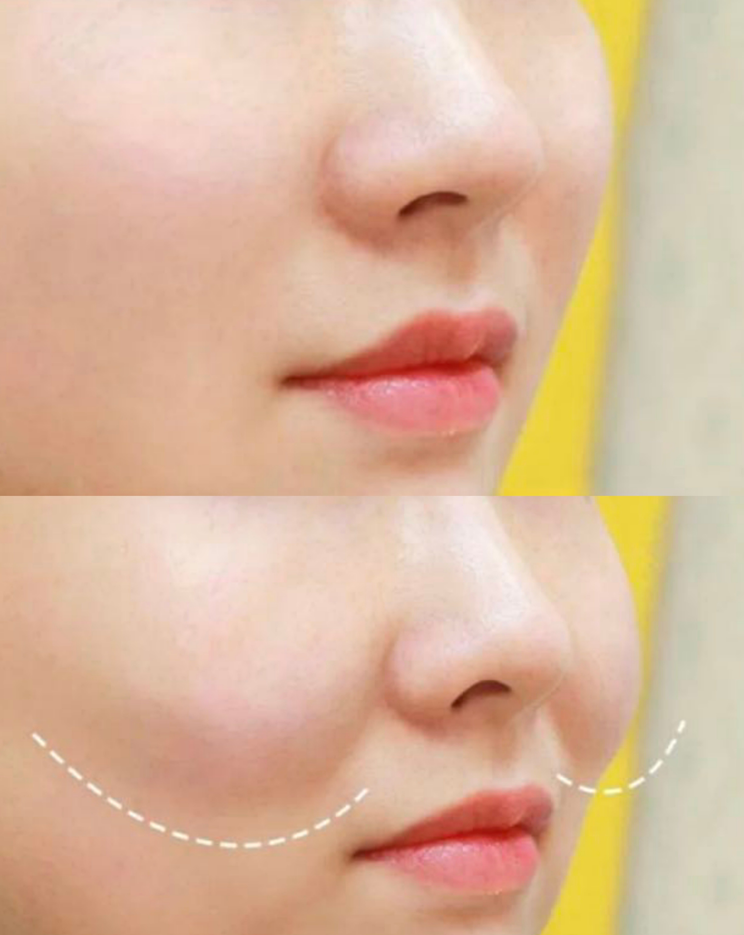 脸部显嫩一般有什么特征,如何填充自然的苹果肌?