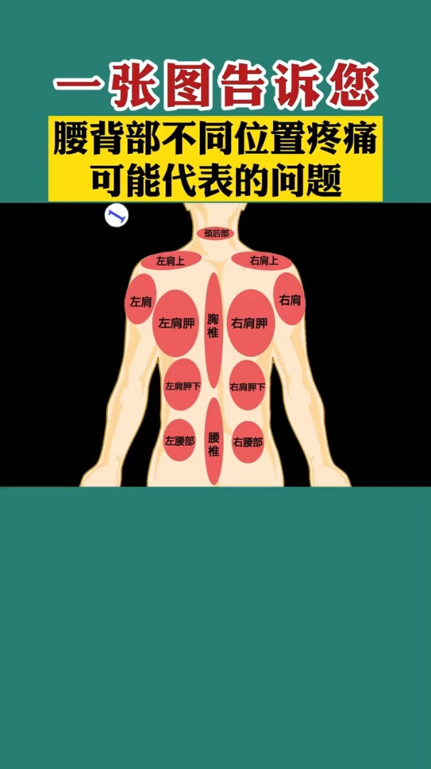 腰背部不同位置疼痛可能代表的问题-度小视