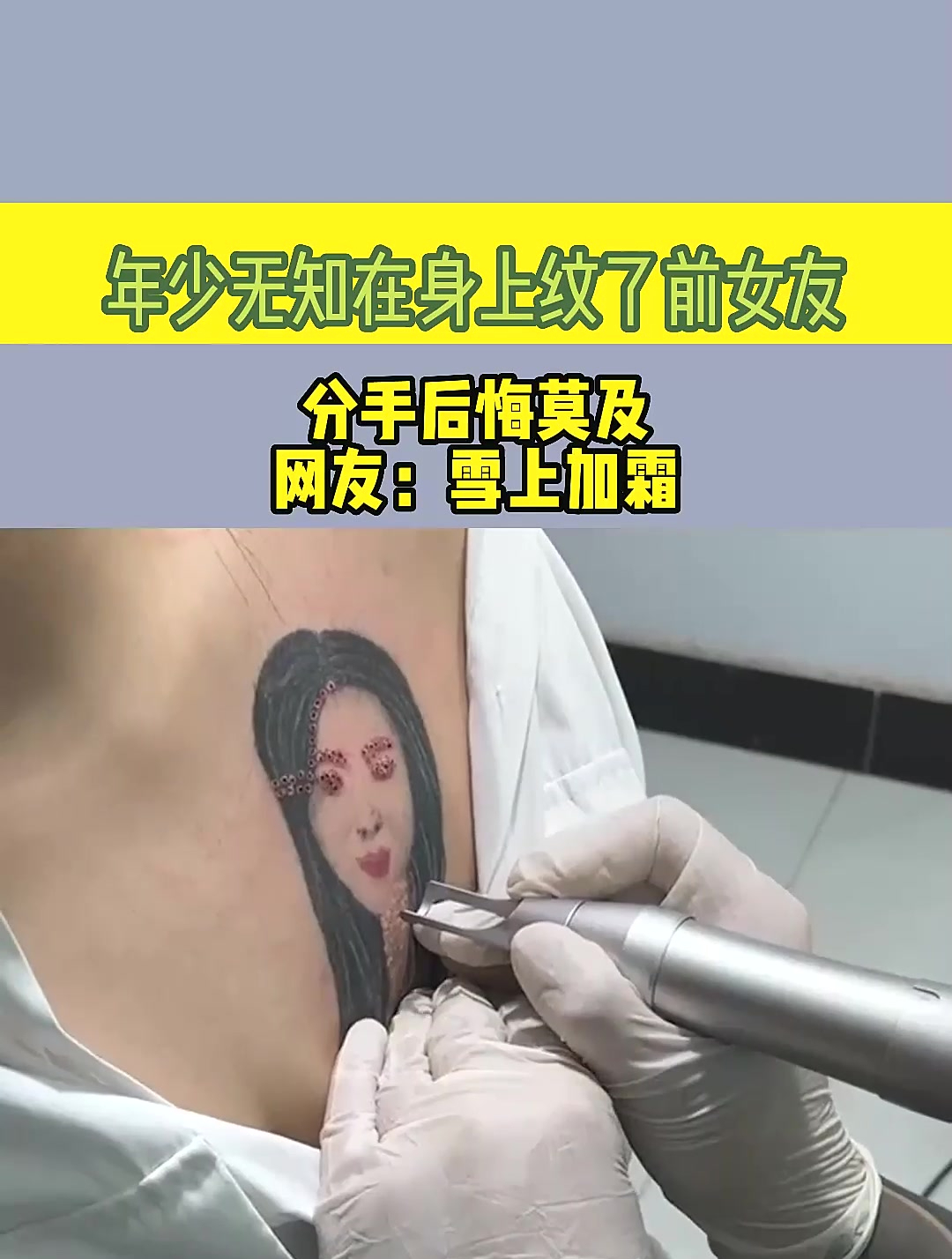年少无知在身上纹了前女友,分手后悔莫及,网友:雪上加霜