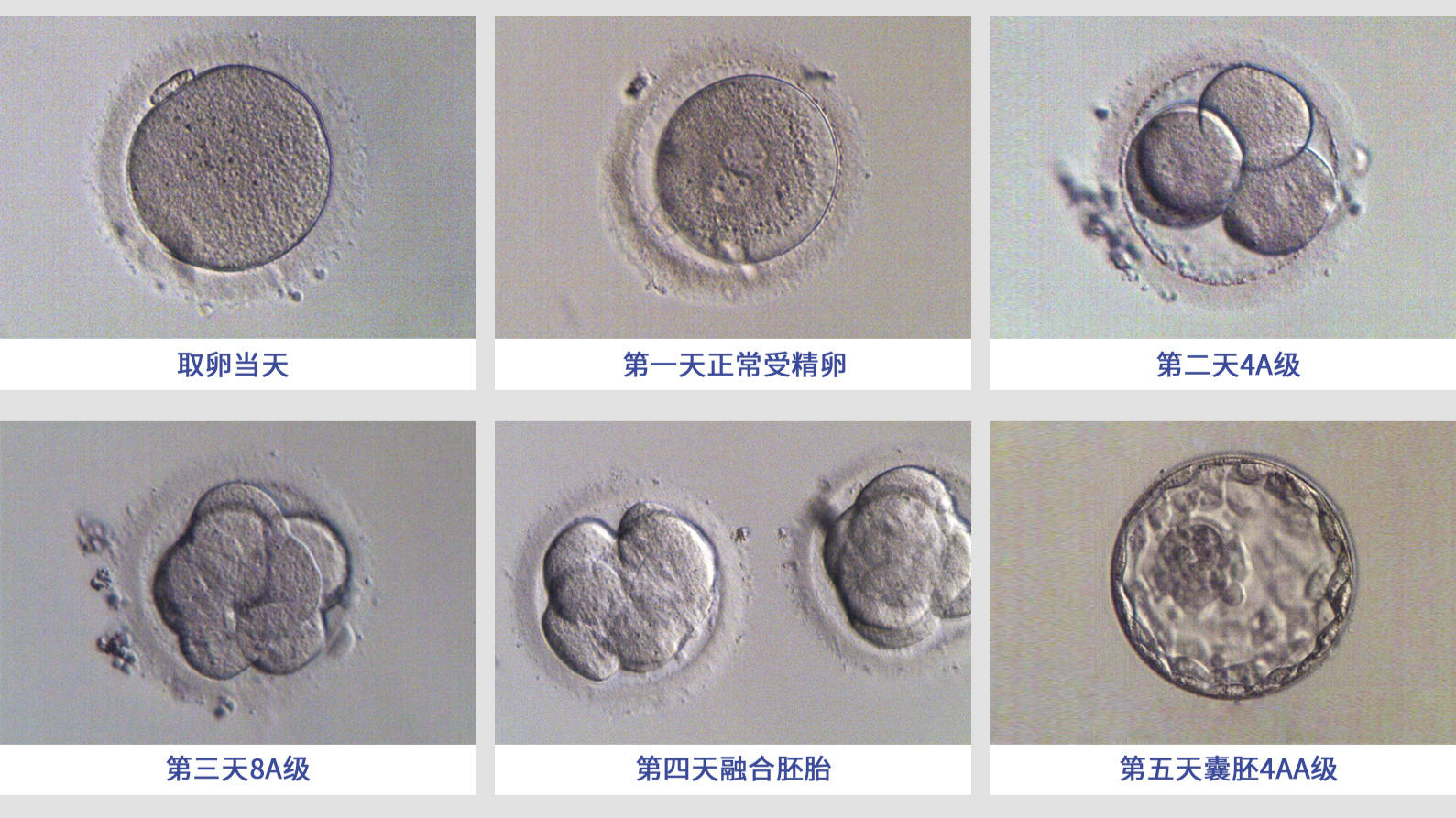 试管移植第三天胚胎图图片