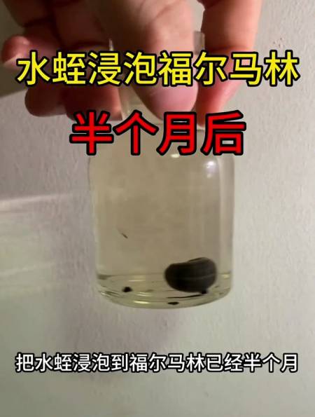 福尔马林浸泡水蛭后续详情可以重温福尔马林浸泡水蛭那期