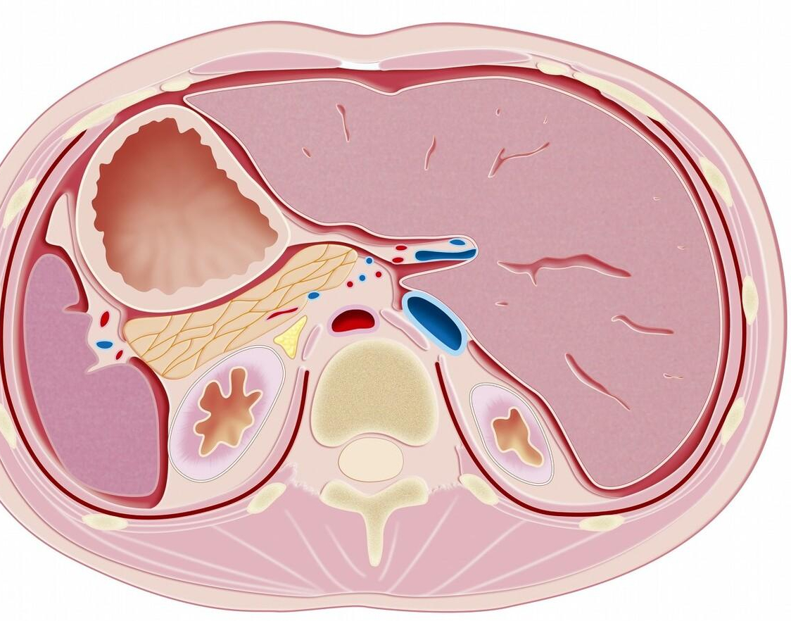 不可忽视的肝血管疾病——布加氏综合征