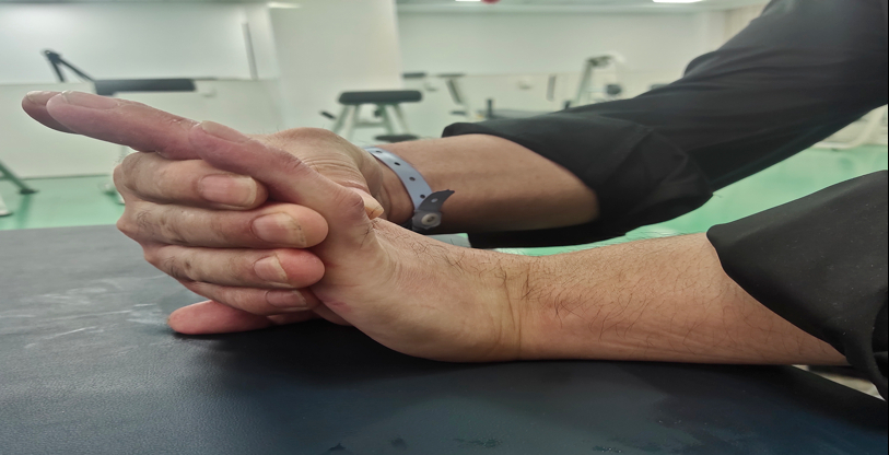 脑卒中偏瘫患者的手部抗痉挛康复,这些训练技巧,请收好