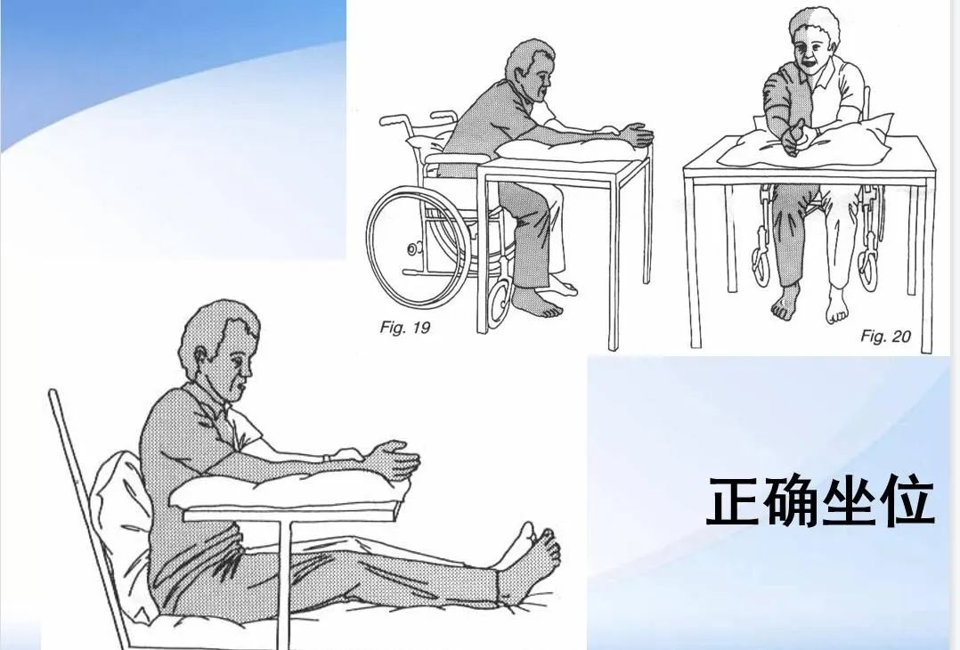 一篇文章了解脑卒中偏瘫患者上下肢的康复训练(图文并茂)