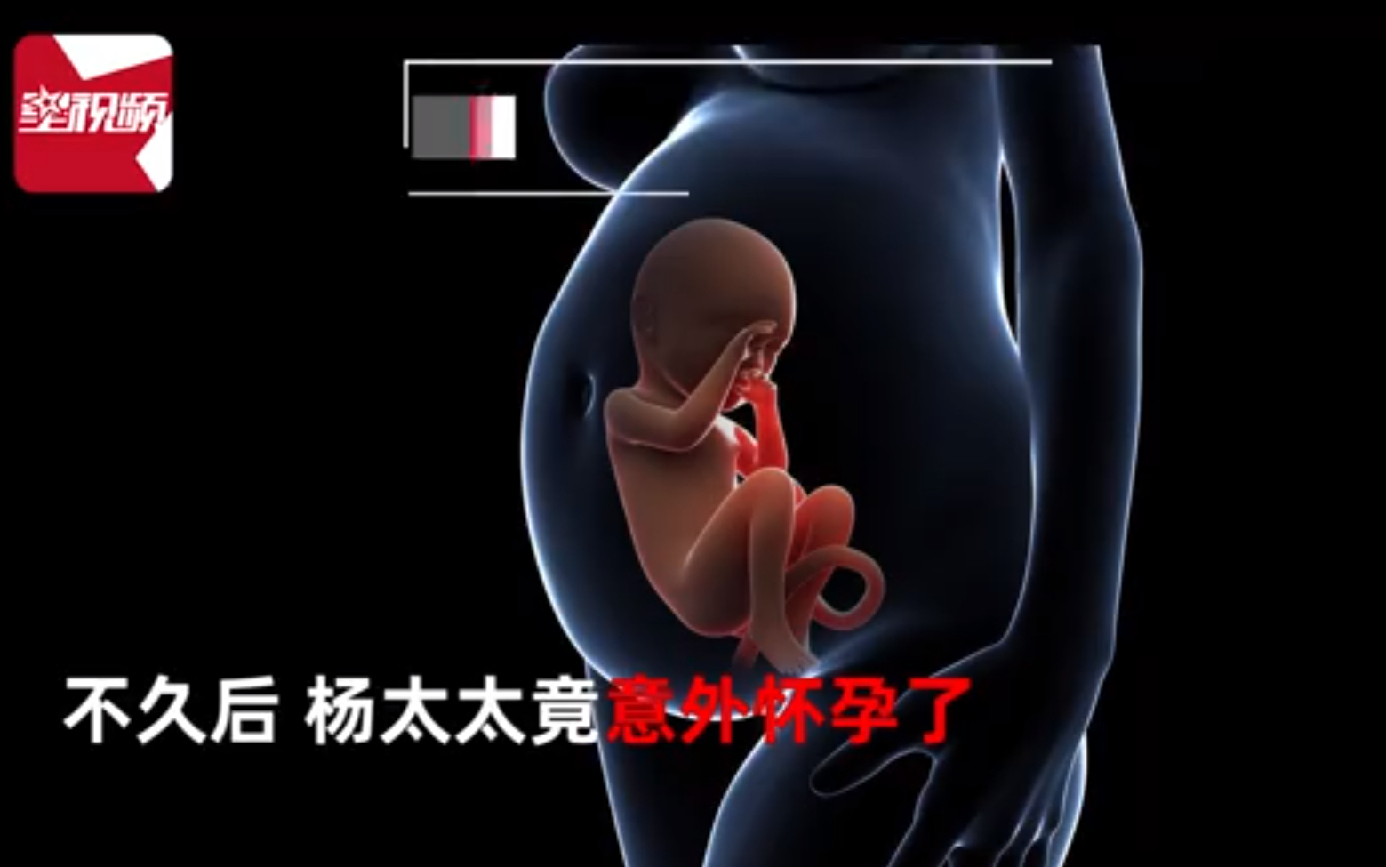 男子2次结扎妻子怀孕2次,双方达成共识