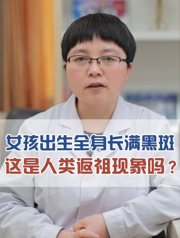 女孩出生身上长满黑斑,这是人类返祖现象吗-度小视