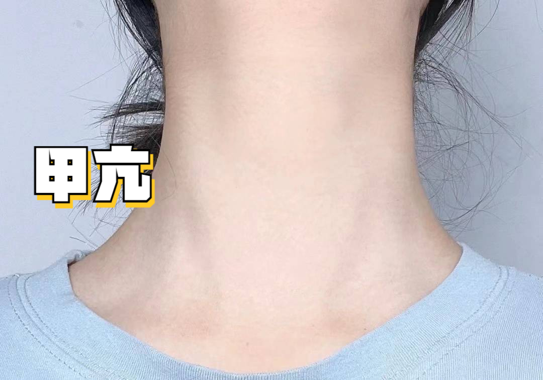 露肤季来了,甲亢粗脖挡不住该怎么办?学会这招,高效抗甲!
