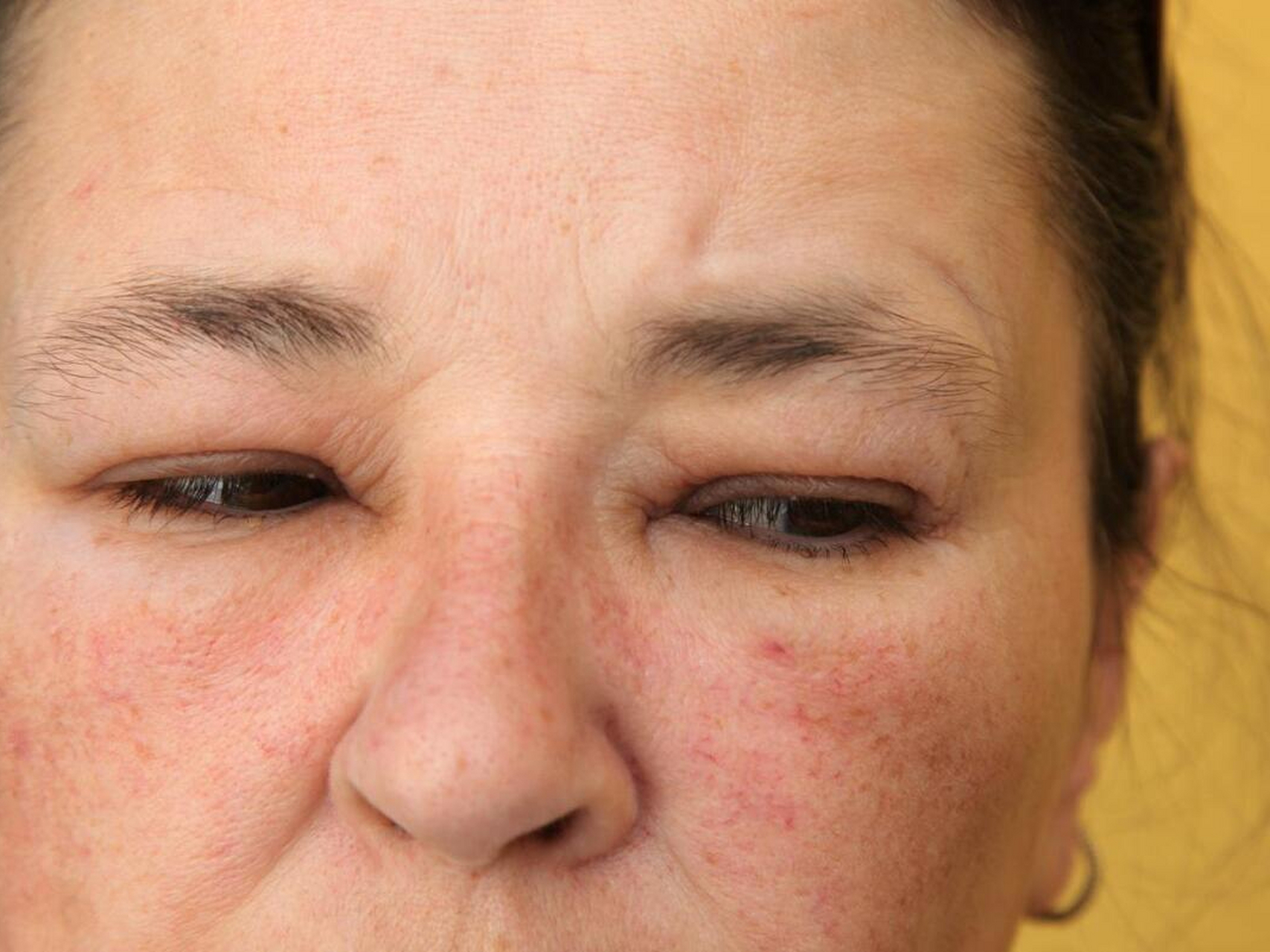 赶快去查一下血常规  1,面色苍白  面色苍白是指面部皮肤失去了正常的